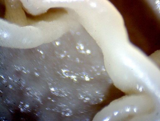 Oidlum lactis под микроскопом «Эврика 40х-1280х» под увеличением 4х