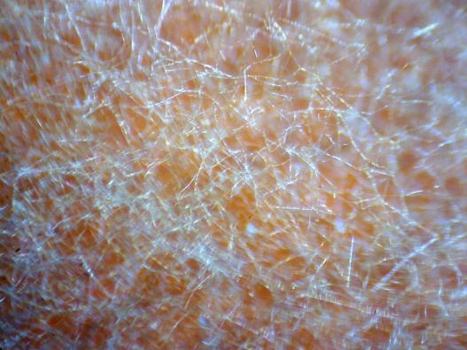 Aspergillus flavus под микроскопом «Эврика 40х-1280х» под увеличением 4х